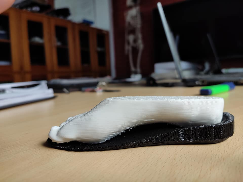 3D printed prosthetic foot